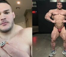 Nick Walker reveals when we'll see him competing again after a horrific injury! 