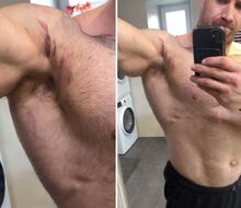 "Unfortunately, I won't be able to compete at the Arnold Sports Festival South America due to injury," says Josef Květoň