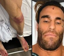"Mám pocit, akoby som sa práve zobudila z veľmi zlého sna," Calum von Moger je živý a zdravý