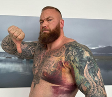 "Najväčšie zranenie mojej kariéry," priznáva Hafthor Bjornsson