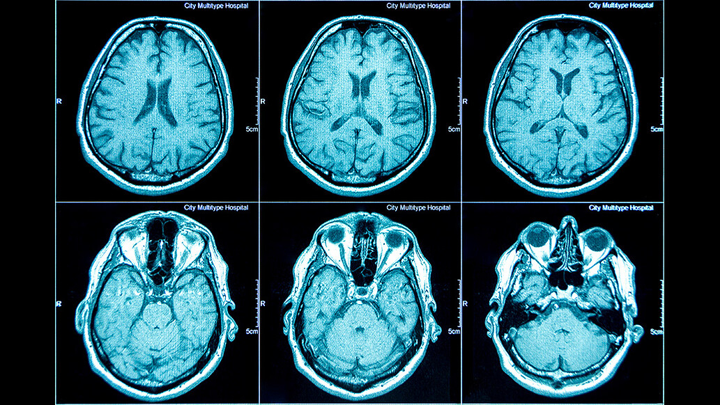 AS users brain