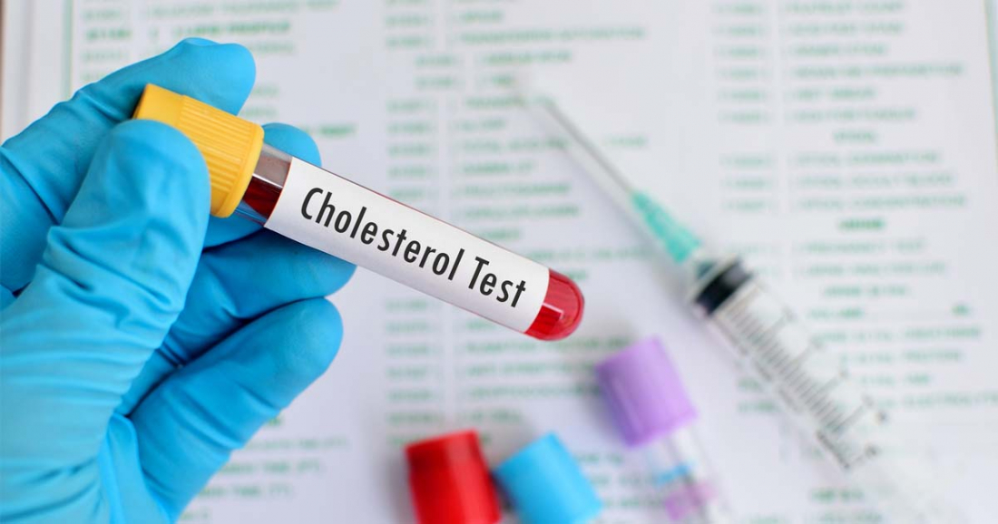 Cholesterol test